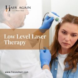 Low level laser therapy-min