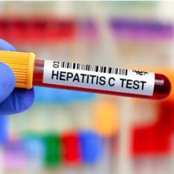 Free Hep-C Testing2