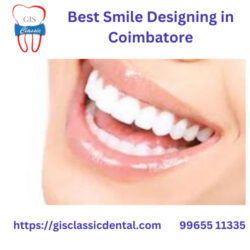 10.best-smile-designing-in-coimbatore