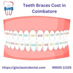 8.teeth braces cost in coimbatore