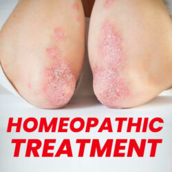 Homeopathic Treatment