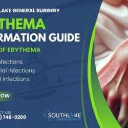 Erythema Information Guide