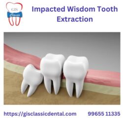 7.impacted wisdom tooth extraction