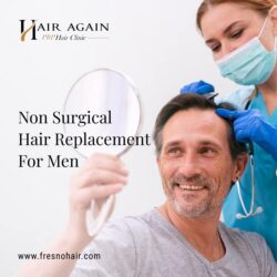 non surgical hair restoration-1-min (1)