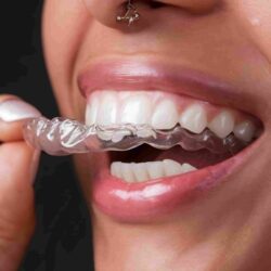 close-up-invisalign-black-background-min