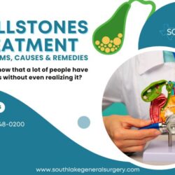 Gallstones Treatment - Symptoms, Causes & Remedies