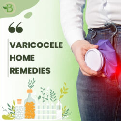 varicocele home remedies