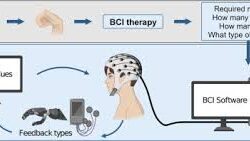 BCI Devices for Therapy