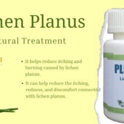 Supplements for Lichen Planus 1