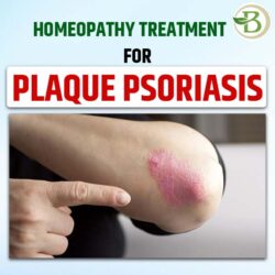 Psoriasis 3 (1)