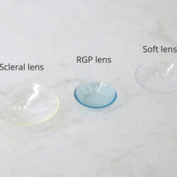 RGP-Contact-Lens