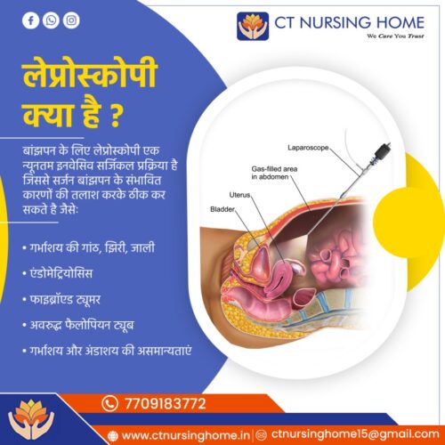 Laparoscopic - Hindi Laparoscopic - Hindi