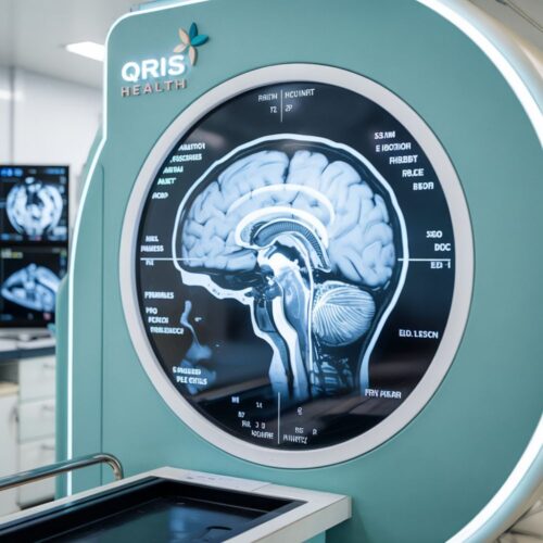 mri brain cost in delhi mri brain cost in delhi