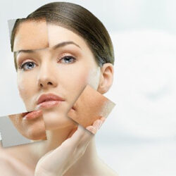 de-skin