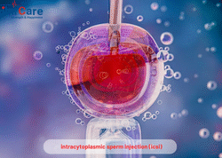 ICSI Treatment in India - Edhacare
