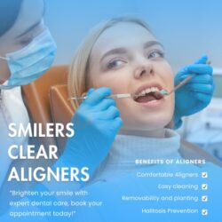 Are Smilers Clear Aligners Worth It