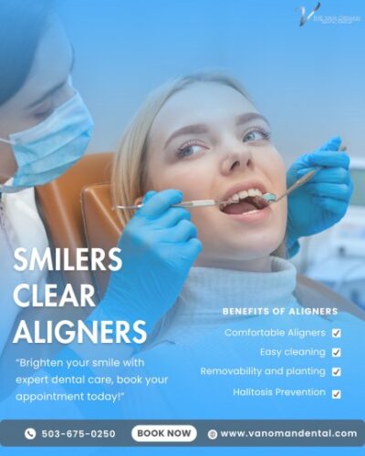 Are Smilers Clear Aligners Worth It Are Smilers Clear Aligners Worth It