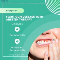 Arestin Treatment