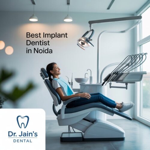 Best Implant Dentist In Noida Best Implant Dentist In Noida