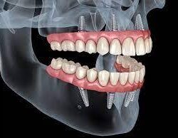 images (2)