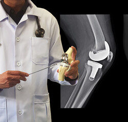 Total knee replacement