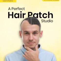 hair patch1