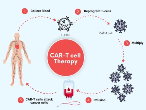 Pi7_Tool_1734176197car-t-cell-therapy Pi7_Tool_1734176197car-t-cell-therapy