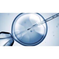 ivf with icsi (1)