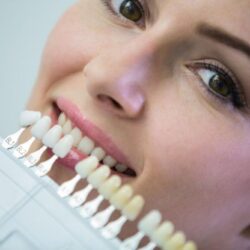 Dental Veneers Special – Restore Confidence in Your Smile
