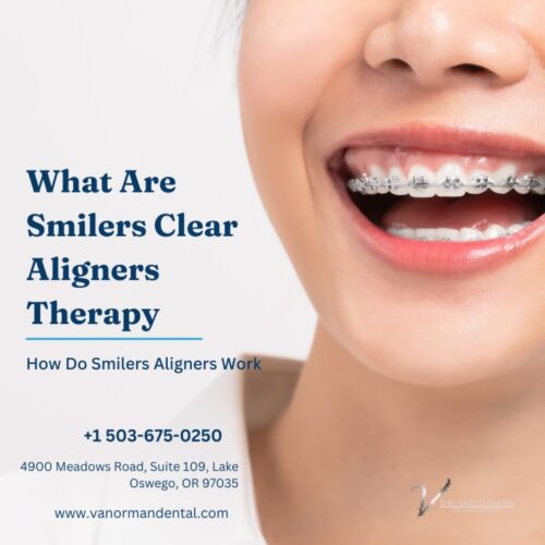 Smilers Clear Aligners Therapy Smilers Clear Aligners Therapy
