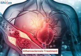 1718087261atherosclerosis-treatment 1718087261atherosclerosis-treatment