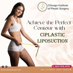 Liposuction Chicago