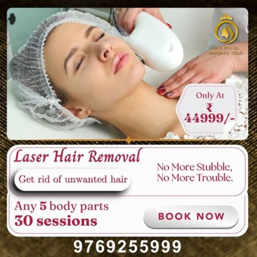 laser treatment (1) laser treatment (1)