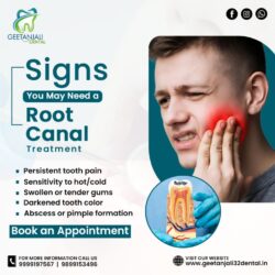 Root Canal Treatment in Gaur City with Expert Care (1)