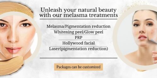 melasma treatment (1) melasma treatment (1)
