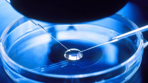 ivf treatment in usa ivf treatment in usa