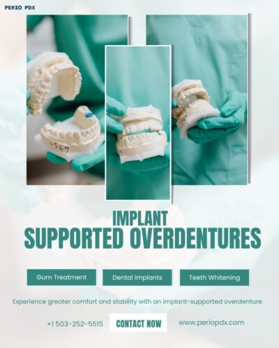 Implant-Supported Overdentures Implant-Supported Overdentures
