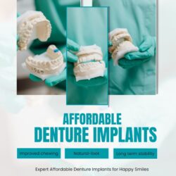 Affordable Denture Implants