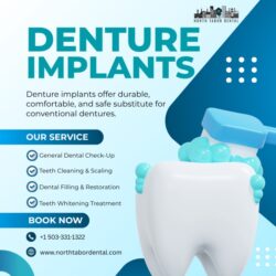 Modern Denture Implants