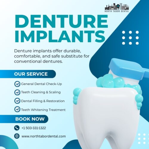 Modern Denture Implants Modern Denture Implants