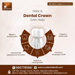 DentistinIndirapuram-jpg-