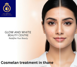 Cosmelan treatment in thane (1) (1)