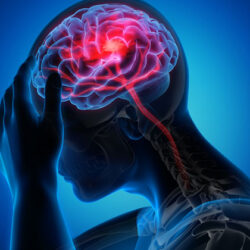 concussion-therapy