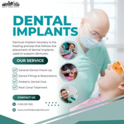 Dentures Implants Recovery