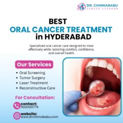 ORAL CANCER TREATMENT