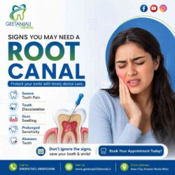 RootCanalTreatmentinGaurCit