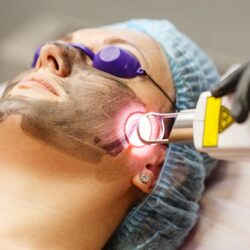Laser-treatment 9979