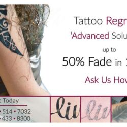 imgi_23_Tattoo-Removal-No-Background-768x432
