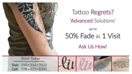 imgi_23_Tattoo-Removal-No-Background-768x432 imgi_23_Tattoo-Removal-No-Background-768x432