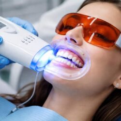 teeth whitening